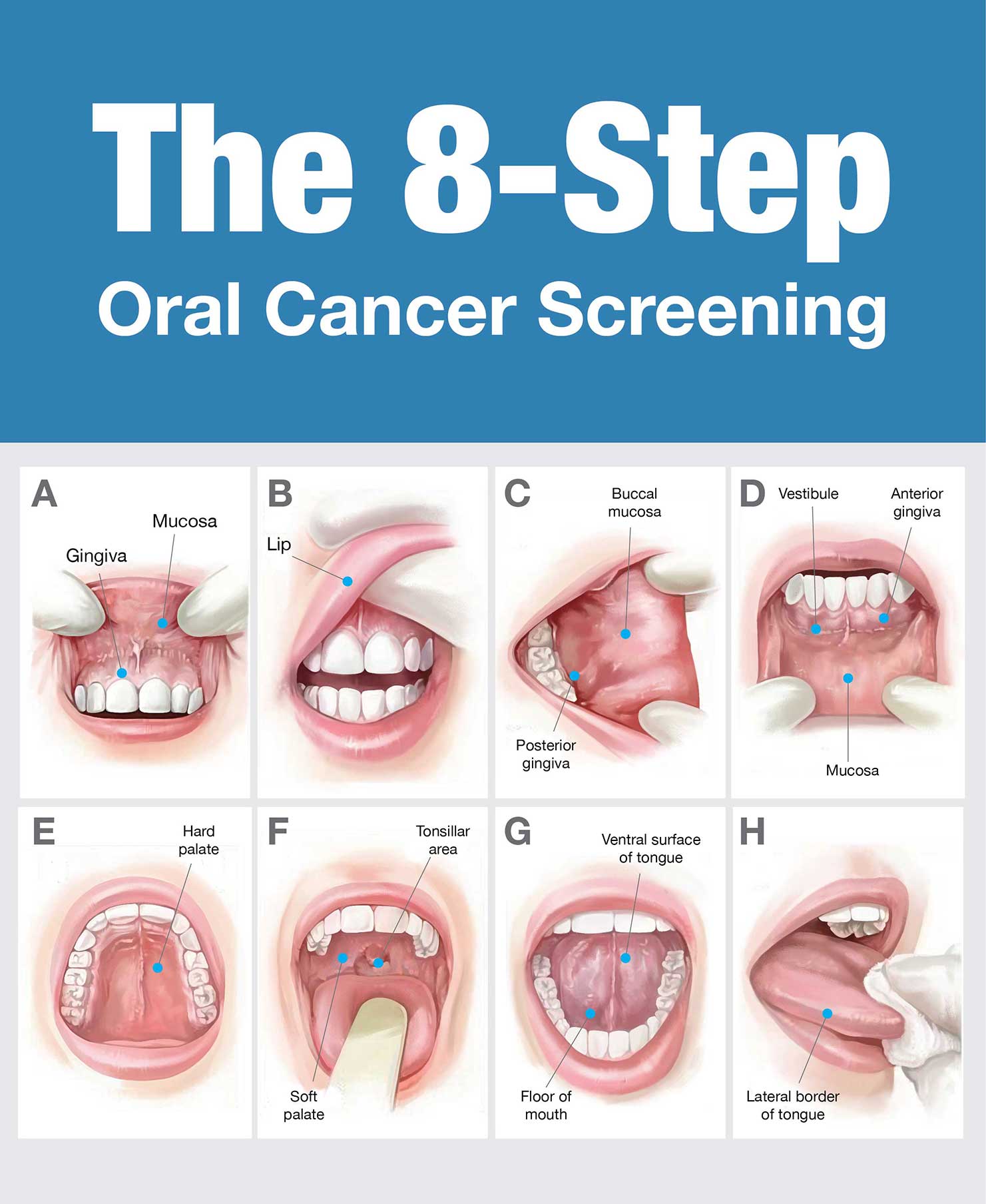 Oral Cancer Best Dental Clinic in Rajapalayam,Best Dental Hospital ...